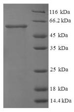 Recombinant Human N-acetyl-D-glucosamine kinase (NAGK)