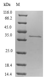 Recombinant Human p53-regulated apoptosis-inducing protein 1 (TP53AIP1)