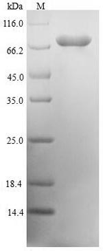 Recombinant Human mRNA-decapping enzyme 1A (DCP1A)