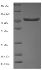 Recombinant Human Serine/threonine-protein kinase PAK 5 (PAK5), partial