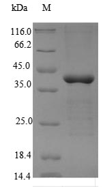 Recombinant Human 5'-AMP-activated protein kinase subunit gamma-2 (PRKAG2)