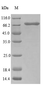 Recombinant Human Ubiquitin-associated domain-containing protein 1 (UBAC1) (Active)