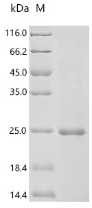 Recombinant Human Platelet-derived growth factor D (PDGFD), partial