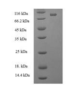 Recombinant Human ATP-dependent RNA helicase DDX19A (DDX19A)
