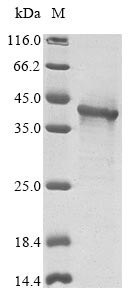 Recombinant Human Interferon kappa (IFNK)