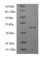 Recombinant Human Hematological and neurological expressed 1 protein (HN1)