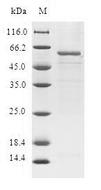 Recombinant Human Trans-1,2-dihydrobenzene-1,2-diol dehydrogenase (DHDH)