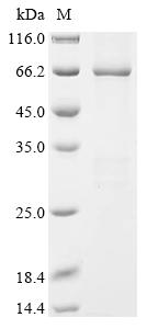 Recombinant Human F-box/WD repeat-containing protein 11 (FBXW11)
