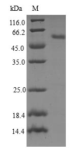 Recombinant Human Ras-related protein Rab-23 (RAB23)