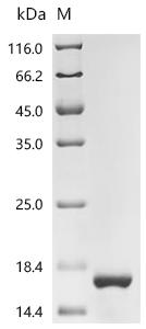 Recombinant Human Sal-like protein 4 (SALL4), partial