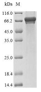 Recombinant Mouse E3 ubiquitin-protein ligase parkin (Prkn)