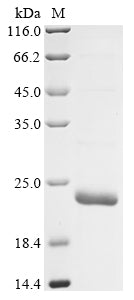 Recombinant Mouse Inositol 1,4,5-triphosphate receptor associated 1 (Irag1), partial