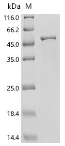 Recombinant Mouse Actin-related protein 2/3 complex subunit 1B (Arpc1b)