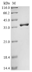 Recombinant Sesamum indicum 11S globulin seed storage protein 2, partial