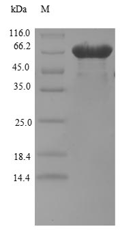 Recombinant Human eIF5-mimic protein 1 (BZW2) (Active)