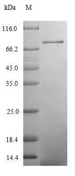 Recombinant Human Coiled-coil domain-containing protein 41 (CCDC41)