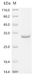 Recombinant Human PRELI domain-containing protein 1, mitochondrial (PRELID1)