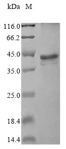 Recombinant Human Small kinetochore-associated protein (KNSTRN)
