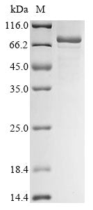 Recombinant Human YTH domain-containing family protein 2 (YTHDF2)