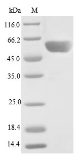 Recombinant Human Serine/threonine-protein phosphatase 2A 55 kDa regulatory subunit B gamma isoform (PPP2R2C)