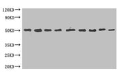 MBP-tagged fusion protein(20ng/ml) was subjected to SDS-PAGE followed by Western Blot with CSB-MA000061M0m at dilution of Lane 1:1000 Lane 4:8000 Lane 7:64000 Lane 2:2000 Lane 5:16000 Lane 8:128000 Lane 3:4000 Lane 6:32000 Lane 9:256000 Secondary...