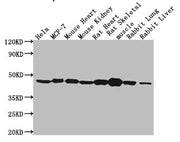 Western Blot Positive WB detected in: Hela whole cell lysate, MCF-7 whole cell lysate, Mouse heart tissue, Mouse kidney tissue, Rat heart tissue, Rat skeletal muscle tissue, Rabbit lung tissue, Rabbit liver tissue All lanes: ACTB antibody at 1:500...