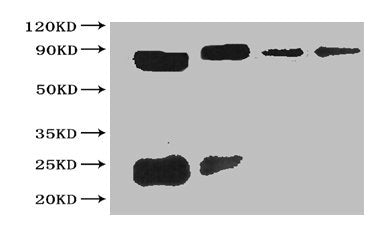 All Lanes The cell supernatant hybridoma of Sumo tag Lane 1 Sumo tagged fusion protein at 20ng Lane 2 Sumo tagged fusion protein at 2ng Lane 3 Sumo tagged fusion protein at 0.2ng Lane 4 Sumo tagged fusion protein at 0.02ng Secondary Goat polyclona...