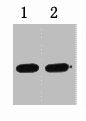 0.5ug GST fusion protein+ Primary antibody dilution at 1) 1:5000 2) 1:10000