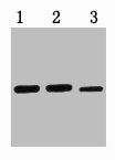 0.5ug MBP fusion protein+ Primary antibody dilution at 1) 1:3000 2) 1:5000 3) 1:10000