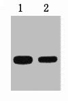 2ug GFP fusion protein+ Primary antibody dilution at 1) 1:5000 2) 1:10000
