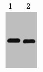 1ug mCherry fusion protein+ Primary antibody dilution at 1) 1:5000 2) 1:10000