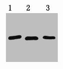 1ug RFP fusion protein+ Primary antibody dilution at 1) 1:3000 2) 1:5000 3) 1:10000