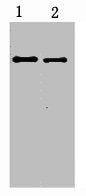 2ug S Tag fusion protein+ Primary antibody dilution at 1) 1:5000 2) 1:10000