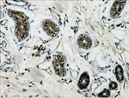 IHC Staining of Human colon tissue, diluted at 1:200.