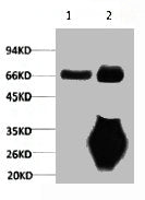 1) Input: Mouse Brain Tissue Lysate 2) IP product: IP dilute 1:200