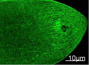 Immunofluorescence Staining of nematode tissue with MYH mouse mAb (11C2) diluted at 1:100. (Provide by Tsinghua University) .