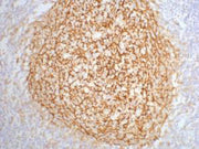 IHC staining of human tonsil tissue, diluted at 1:200.
