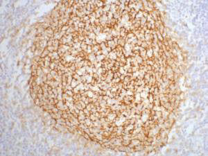 IHC staining of human tonsil tissue, diluted at 1:200.