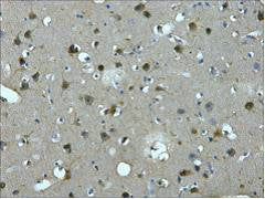 IHC staining of Human brain tissue paraffin-embedded, diluted at 1:200.