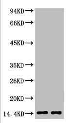 Western blot analysis of Hela, diluted at 1) 1:2000 2) 1:5000
