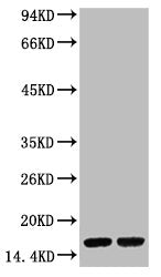Western blot analysis of Hela, diluted at 1) 1:2,000 2) 1:5,000