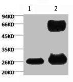 1) Input (control) 2) IP products, antibody dilution 1:200