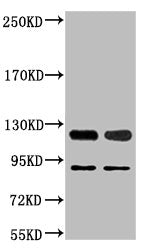 Western blot analysis of 1) Jurkat, 2) Hela, diluted at 1:2000.