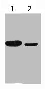 Western blot analysis of His Tag recombinant protein, diluted at 1:10000 1) His-MBP recombinant protein 2) His Tag transfected 293T