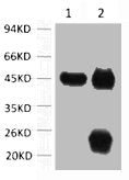 1) Input: Mouse Brain Tissue Lysate 2) IP product: IP dilute 1: 200