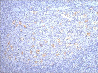 IHC staining of human tonsil tissue, diluted at 1:200.