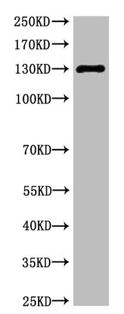 Western blot analysis of Rat Heart Tissue, diluted at 1:1000.