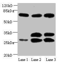 Western blot All lanes: Amyloid beta A4 antibody at 1µg/ml Lane 1: Mouse heart tissue Lane 2: Mouse kidney tissue Lane 3: Mouse lung tissue Secondary Goat polyclonal to Mouse IgG at 1/15000 dilution Predicted band size: 30, 35, 72, 80 kDa Observed...