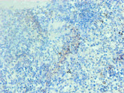 Immunohistochemical of paraffin-embedded human spleen tissue using CSB-MA002401E0m at dilution of 1:200