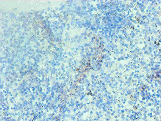 Immunohistochemical of paraffin-embedded human spleen tissue using CSB-MA002401E0m at dilution of 1:200